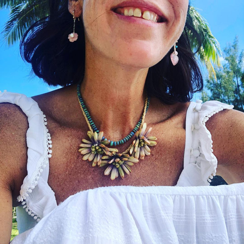 Guys, I bought a sea urchin necklace!